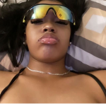 ャetaphil
