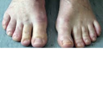 Sus toes