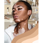 Vitiligo Models