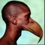 ToeDysmorphia