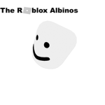 the roblox albinos