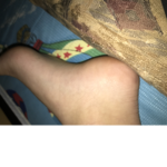 Whydoucare