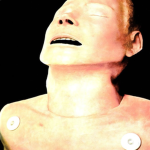 Radioheaad