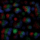 OMG Glitch Infection