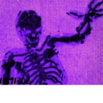 [ die ]