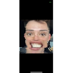 Ugly James Charles