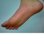 TheToeGroup