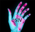 /SIV