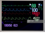 ERGO Medical Technology