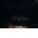 ###########YT