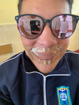 Los tilines insanos