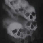 lypophreniaa