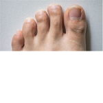Gimme em toes