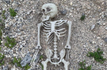 Skeleton people are dead