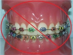 I Hate Braces