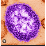 Viruses Party