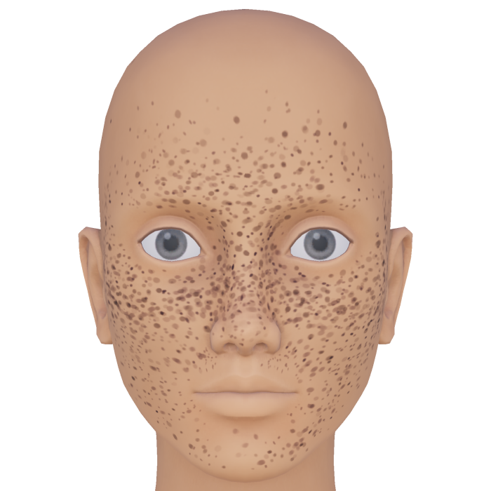 Dramatic Natural Freckles