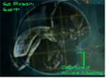 Mantis