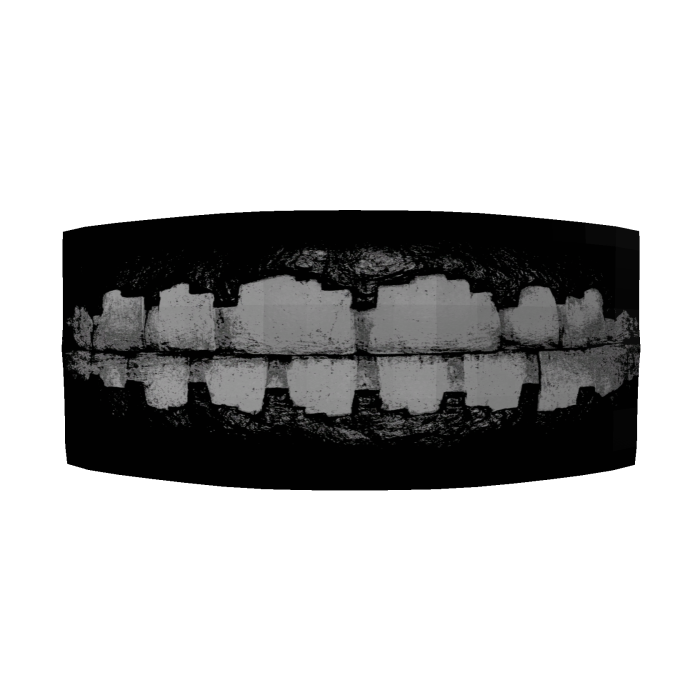 Goth Monster Teeth