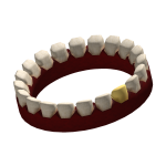 Mafia Member's Dentures