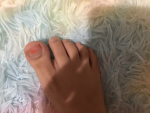 Berry toes
