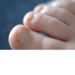TOES UNTIED