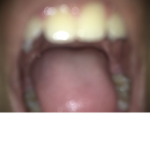 My friends teeth