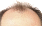 Mi nombre es pelos largos