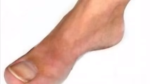 Skupina nenormálních lidí