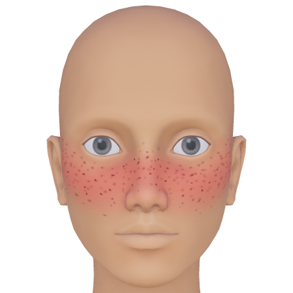 Kawaii Flushed Freckle Blush