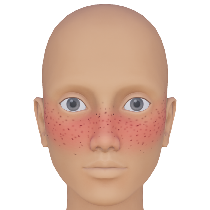Kawaii Flushed Freckle Blush