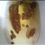 La poop90