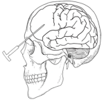 Lobotomy Professionals