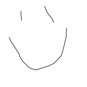 zombie castle attack