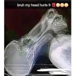 Chetero