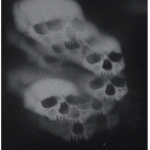 Zombie Hearts