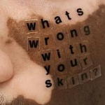 vitiligo vanity