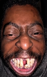 Uncle fried community