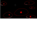Files of blood