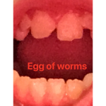 The official Egg of worms group