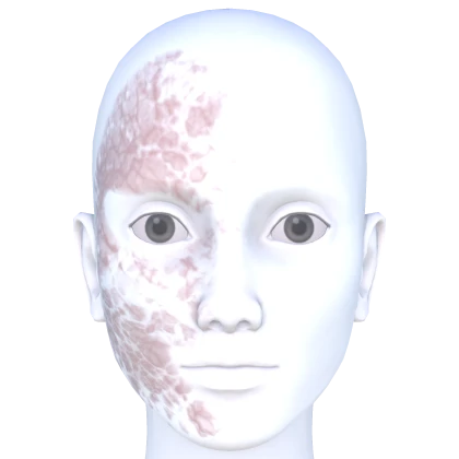 Burned Half Face Mark | Roblox Item - Rolimon's
