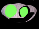 robux for storm