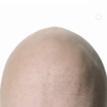 Best Of Baldies