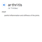 Arthritis