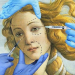 rhinoplasty