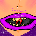 SUCTIONED