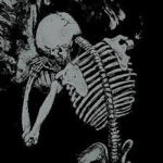 ・skeletal・