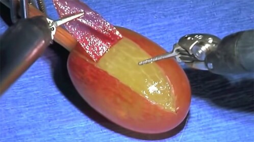 they did surgery on a grape simulator 