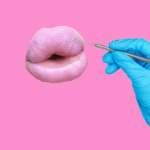 ‘Botched