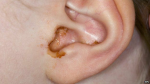 EarWaxClan